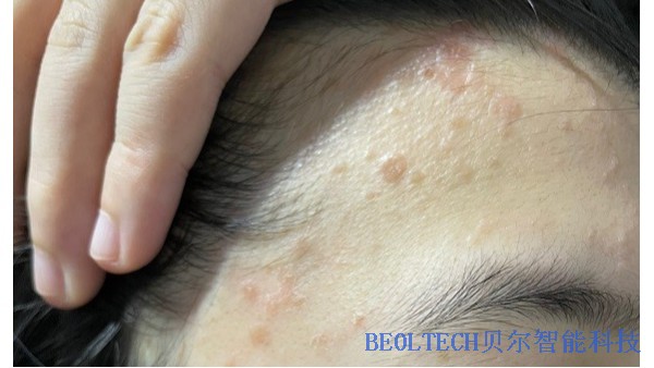 BEOL青島貝爾智能帶您了解醫美用的液氮罐2022.4.14